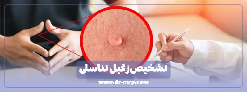 تشخیص زگیل تناسلی