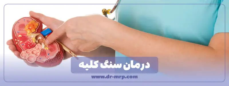 درمان سنگ کلیه