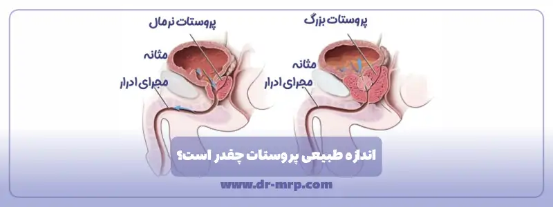 اندازه طبیعی پروستات چقدر است (1)