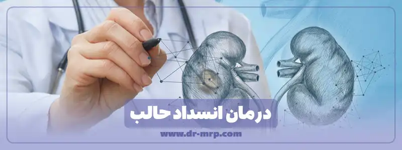 درمان انسداد حالب