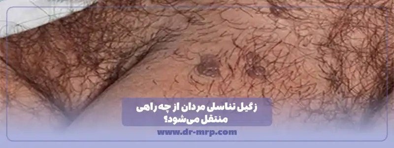 زگیل تناسلی مردان از چه راهی منتقل می شود؟