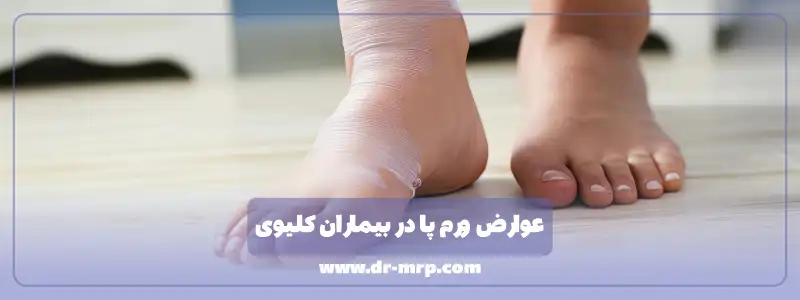 عوارض ورم پا در بیماران کلیوی