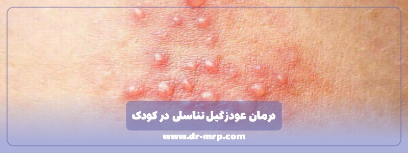 درمان عود زگیل تناسلی در کودک