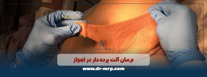 درمان آلت پرده دار در اهواز