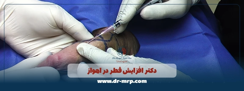 دکتر افزایش قطر در اهواز