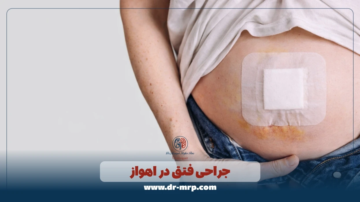 جراحی فتق در اهواز