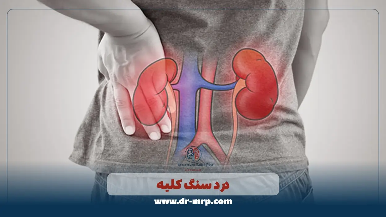 درد سنگ کلیه در کدام قسمتهای بدن احساس میشود؟