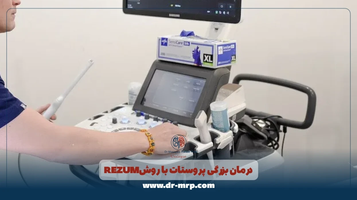 درمان بزرگی پروستات با روش رزوم