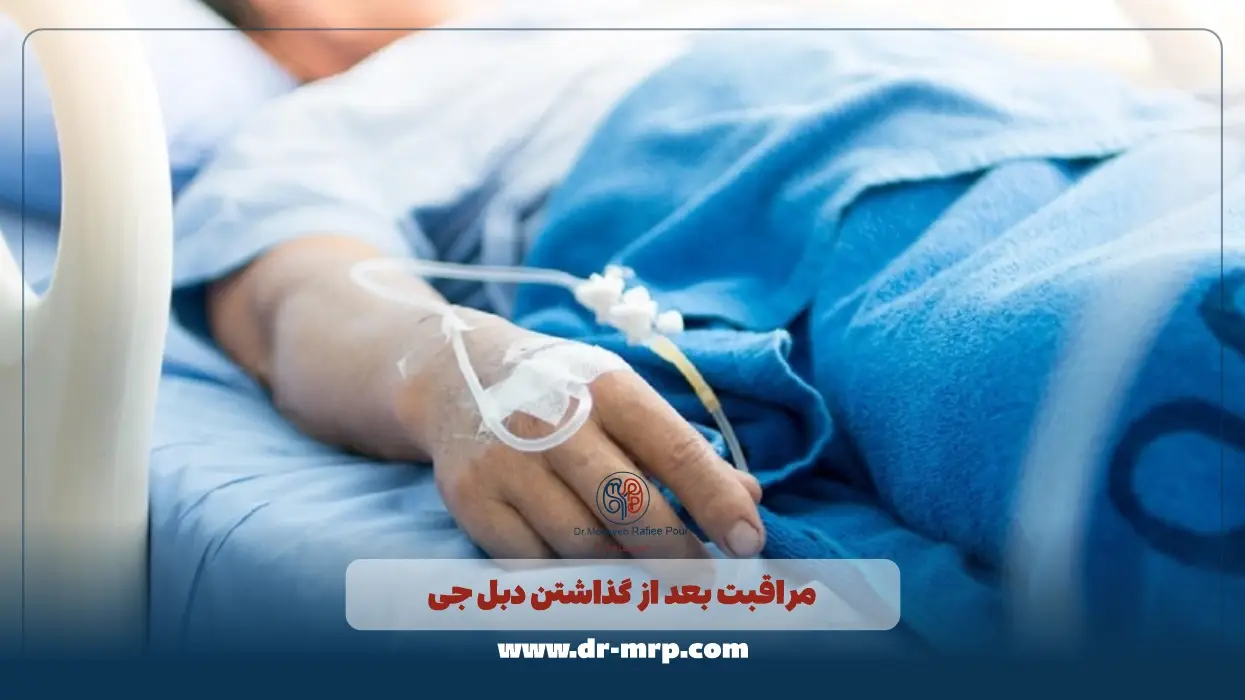 مراقبت بعد از گذاشتن دبل جی