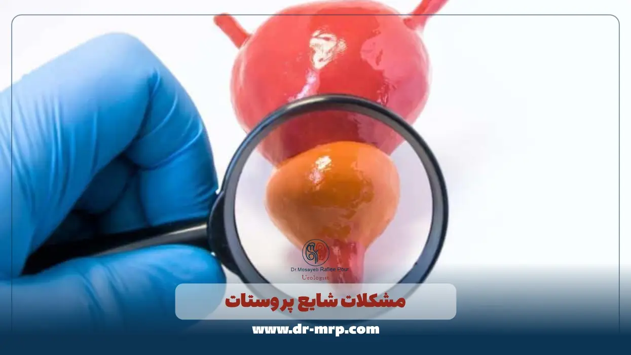 مشکلات شایع پروستات که باعث جستجوی پاکسازی پروستات میشوند