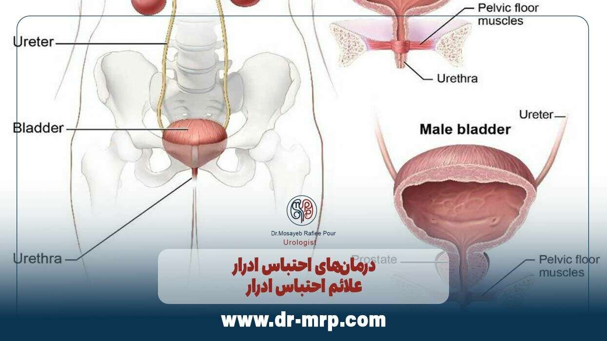 مراحل و روشهای درمان احتباس ادرار