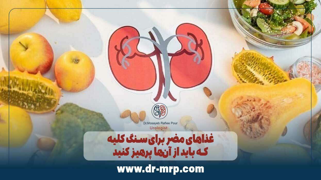 غذاهای مضر برای سنگ کلیه که باید از آنها پرهیز کنید