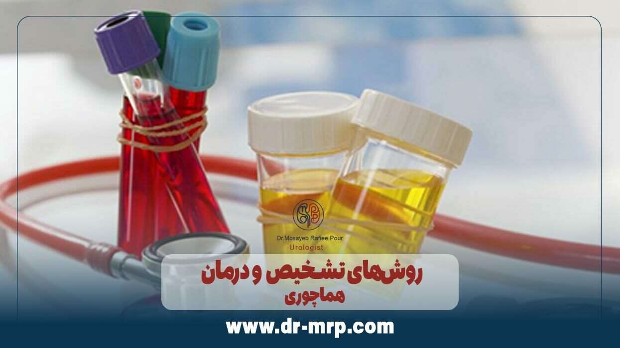 روشهای تشخیص و درمان هماچوری