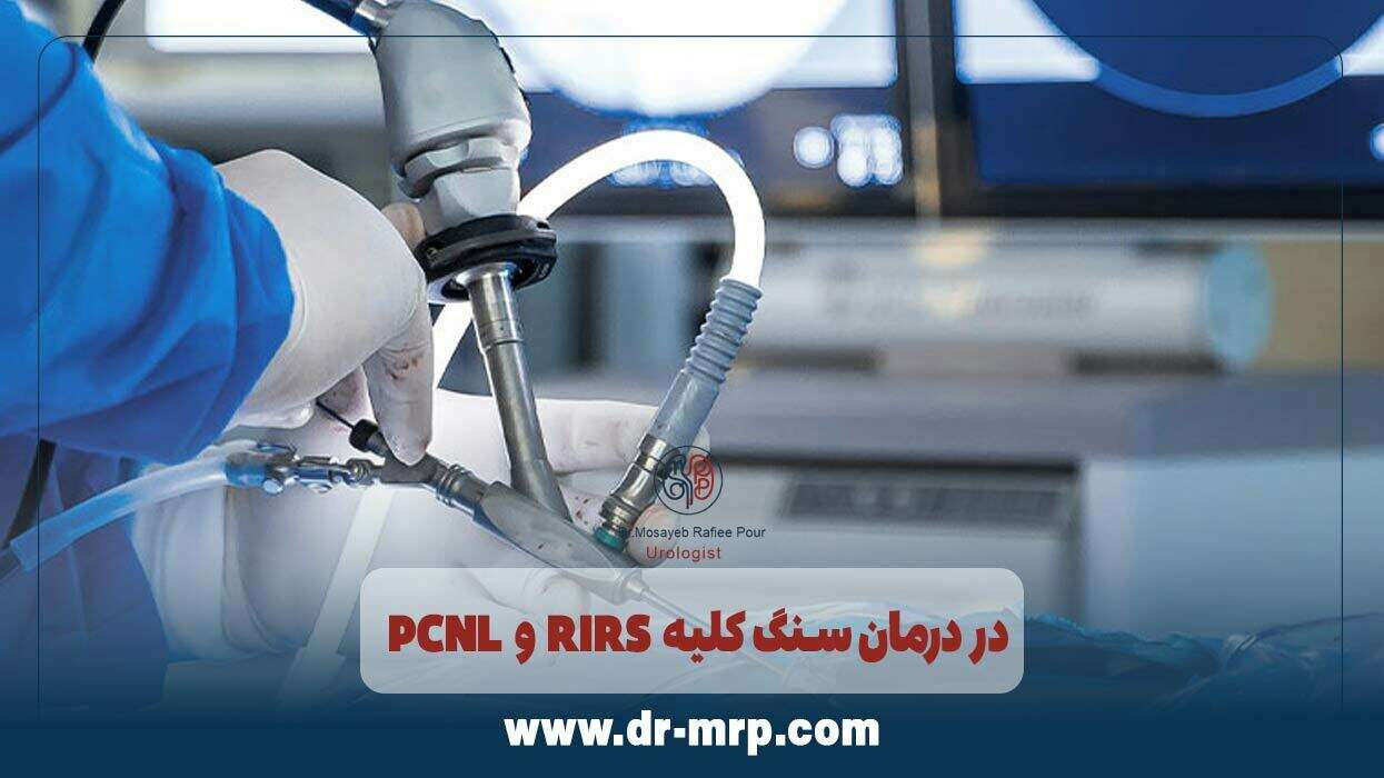 بررسی دقیق تفاوت PCNL و RIRS در درمان سنگ کلیه