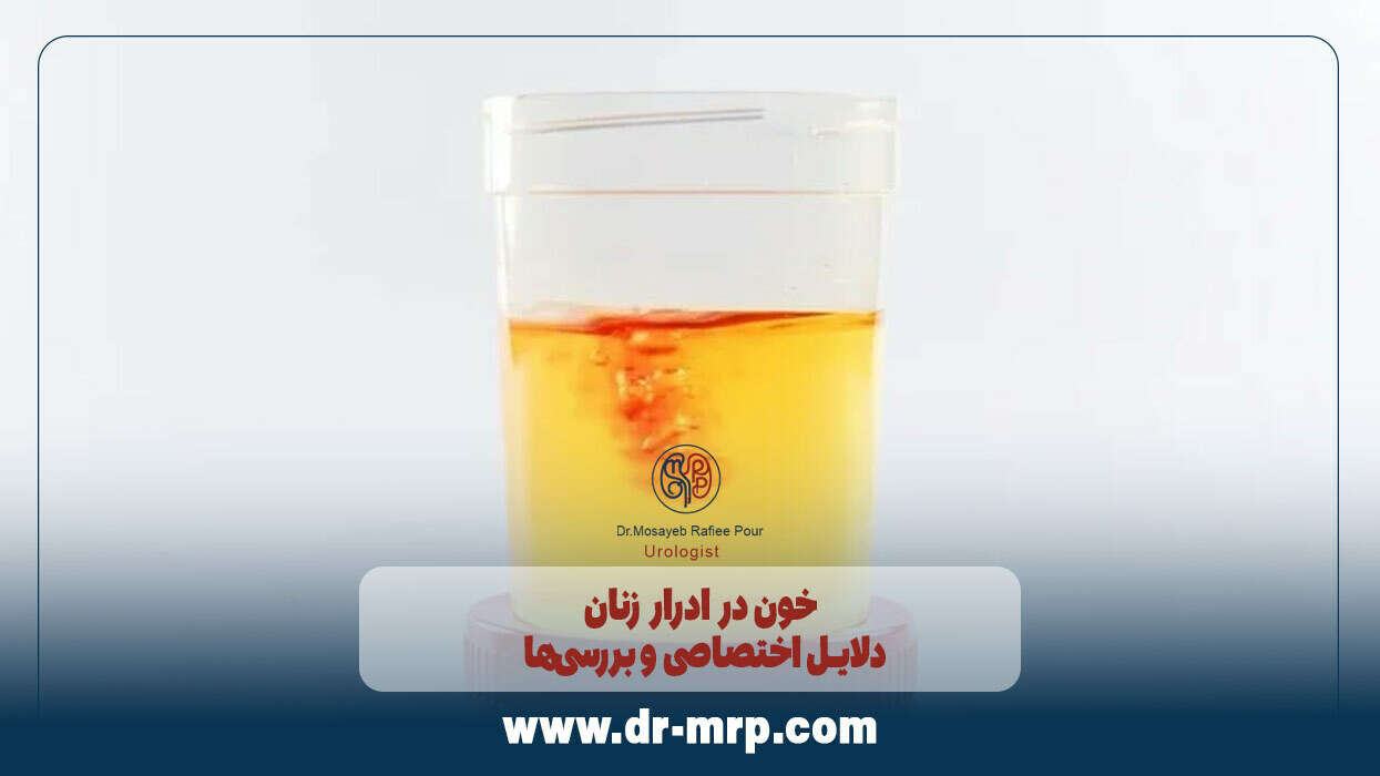 خون در ادرار زنان: دلایل اختصاصی و بررسیها