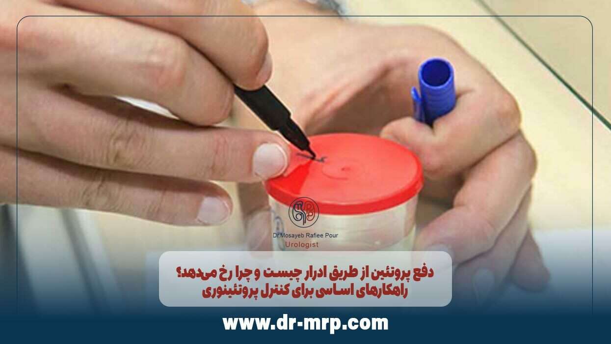 راهکارهای اساسی برای کنترل پروتئینوری