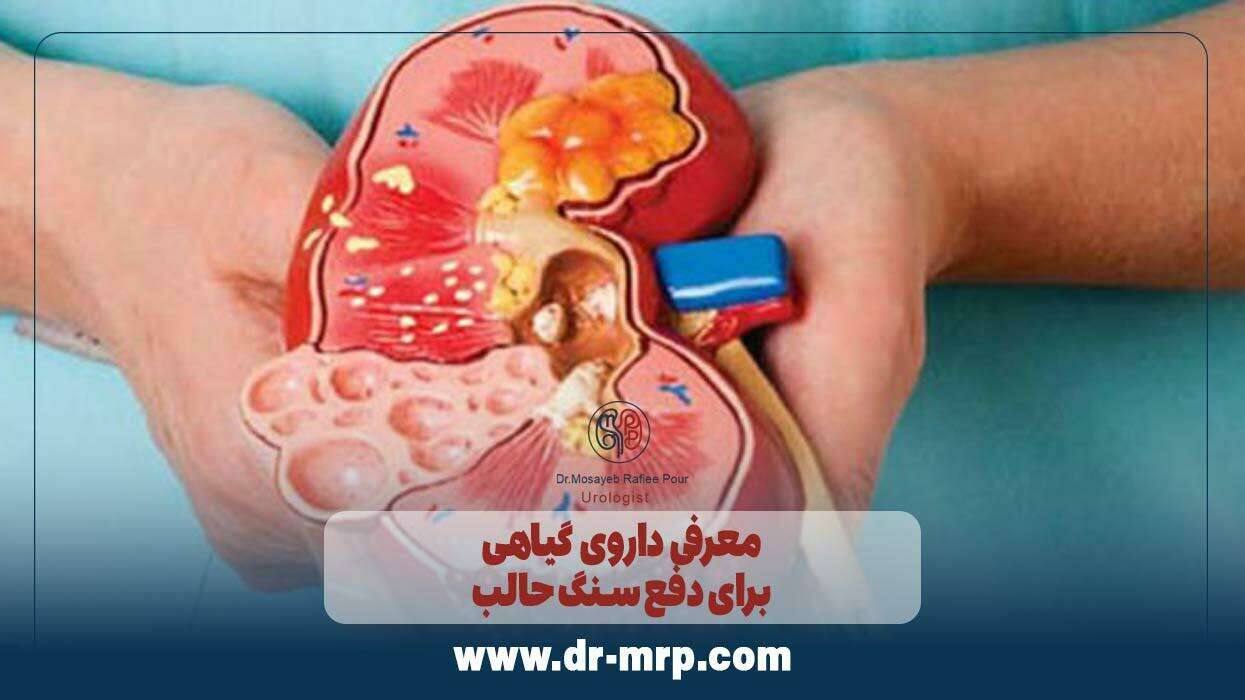 معرفی داروی گیاهی برای دفع سنگ حالب