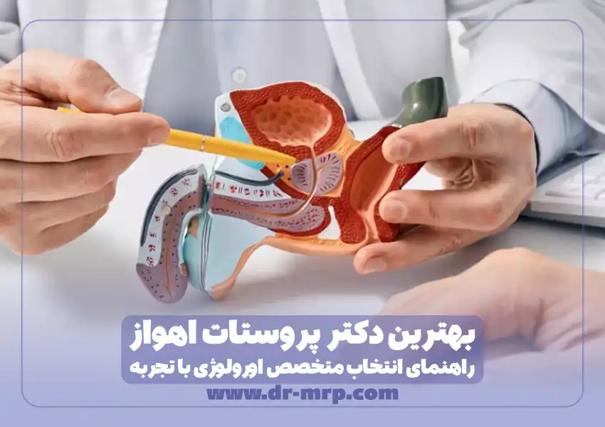 بهترین متخصص پروستات اهواز