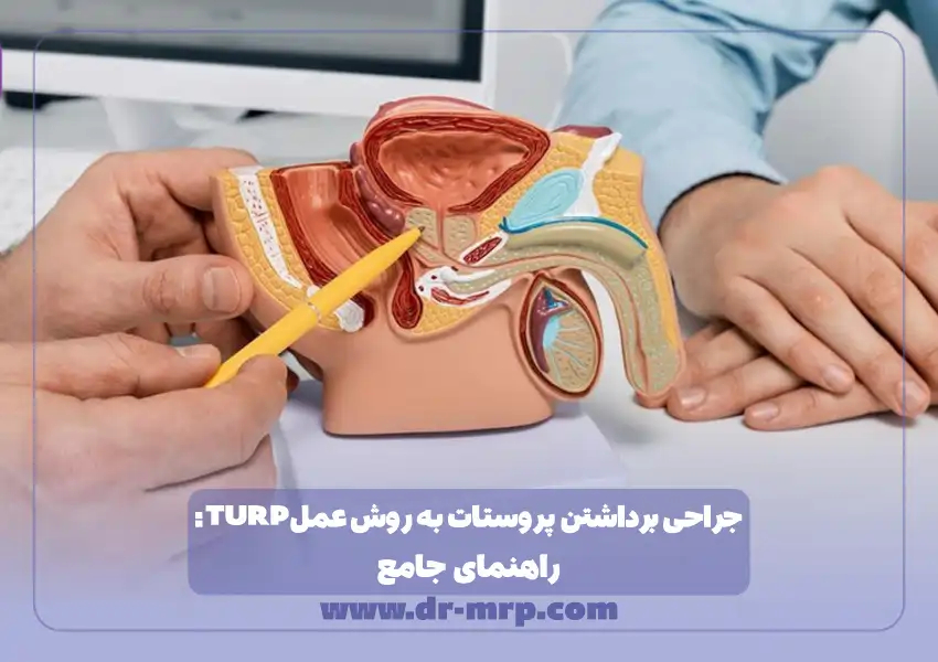 جراحی برداشتن پروستات به روش عمل TURP: راهنمای جامع