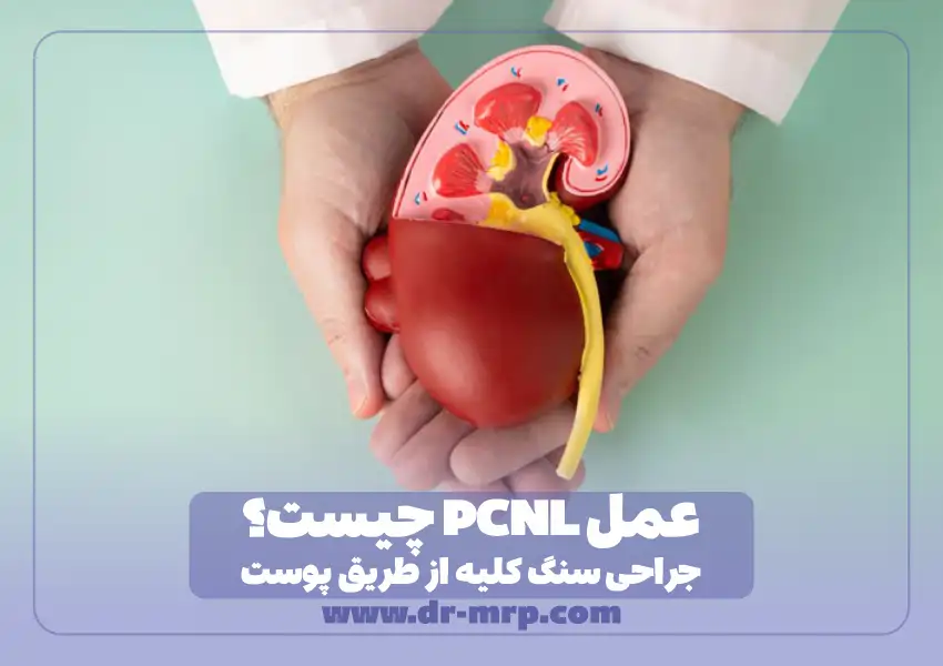 عمل PCNL چیست؟ جراحی سنگ کلیه از طریق پوست