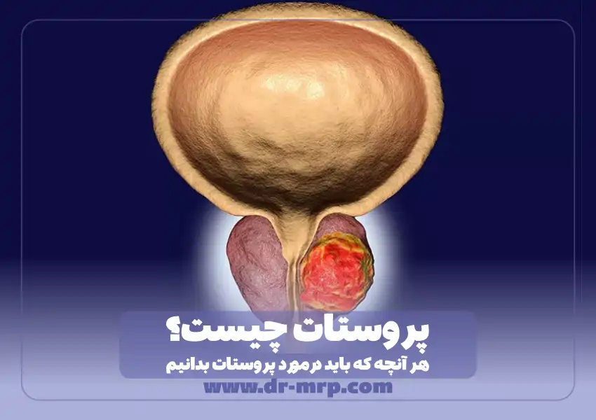 پروستات چیست؟ بررسی پروستات در آقایان