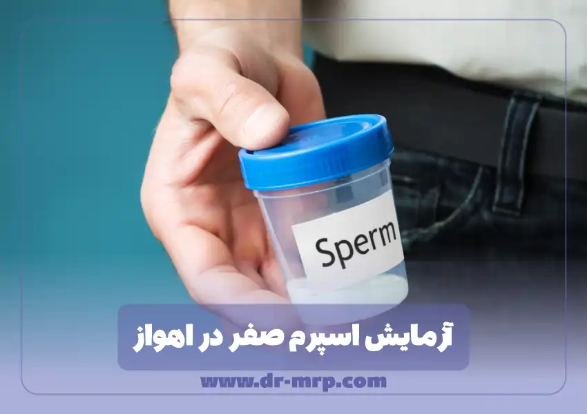 آزمایش اسپرم صفر در اهواز