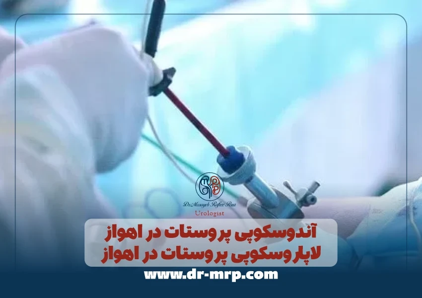 آندوسکوپی پروستات در اهواز | لاپاروسکوپی پروستات در اهواز