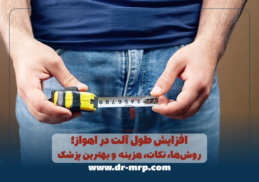 افزایش طول آلت در اهواز؛ روشها، نکات، هزینه و بهترین پزشک