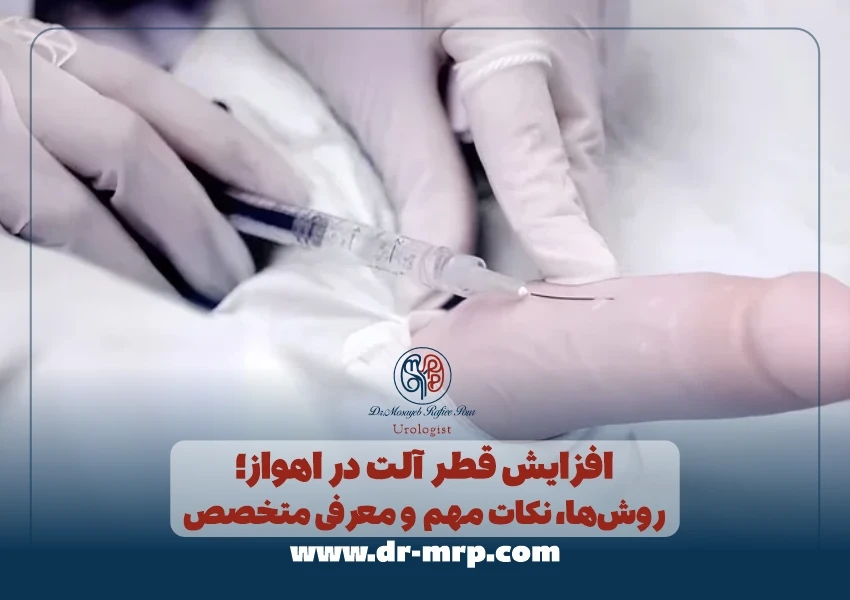 افزایش قطر آلت در اهواز؛ روشها، نکات مهم و معرفی متخصص