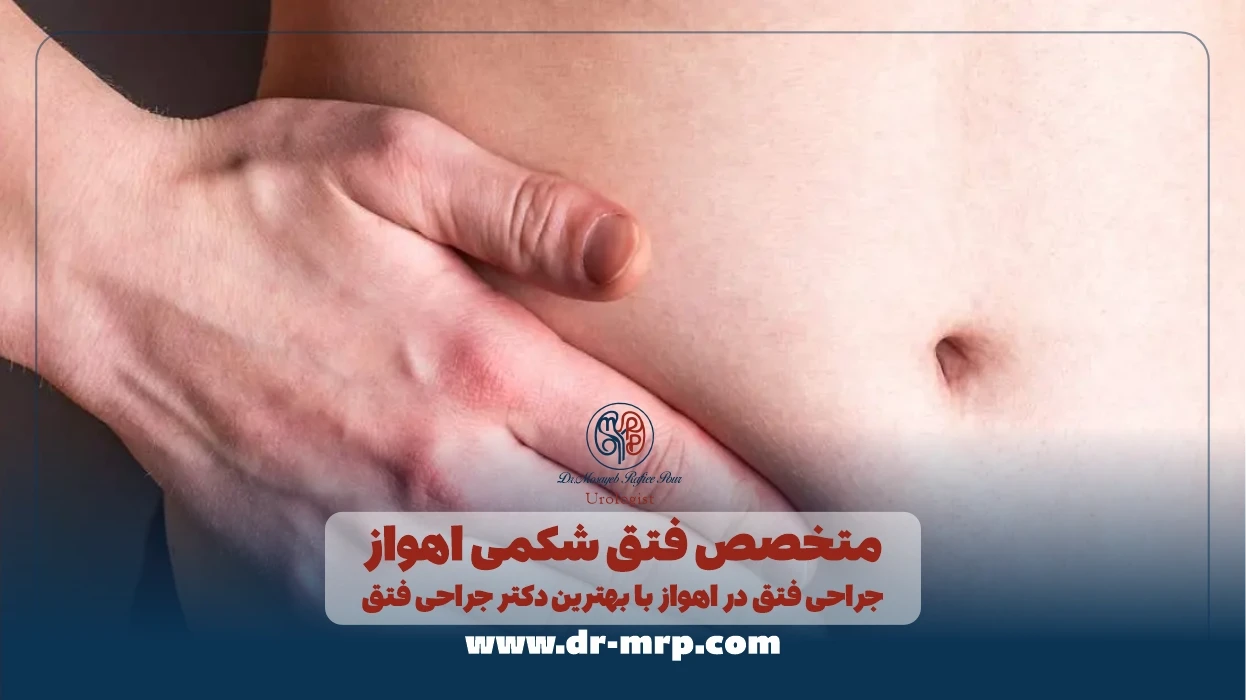 متخصص فتق شکمی اهواز | جراحی فتق در اهواز با بهترین دکتر جراحی فتق