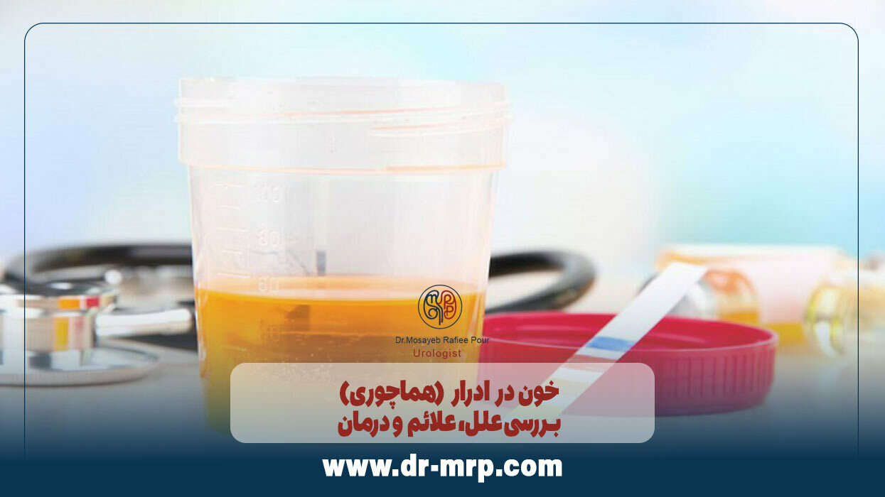 خون در ادرار (هماچوری): بررسی علل، علائم و درمان