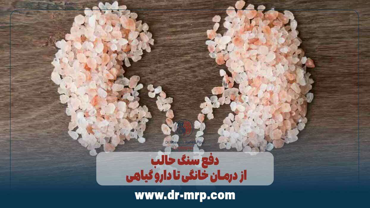 دفع سنگ حالب: از درمان خانگی تا دارو گیاهی